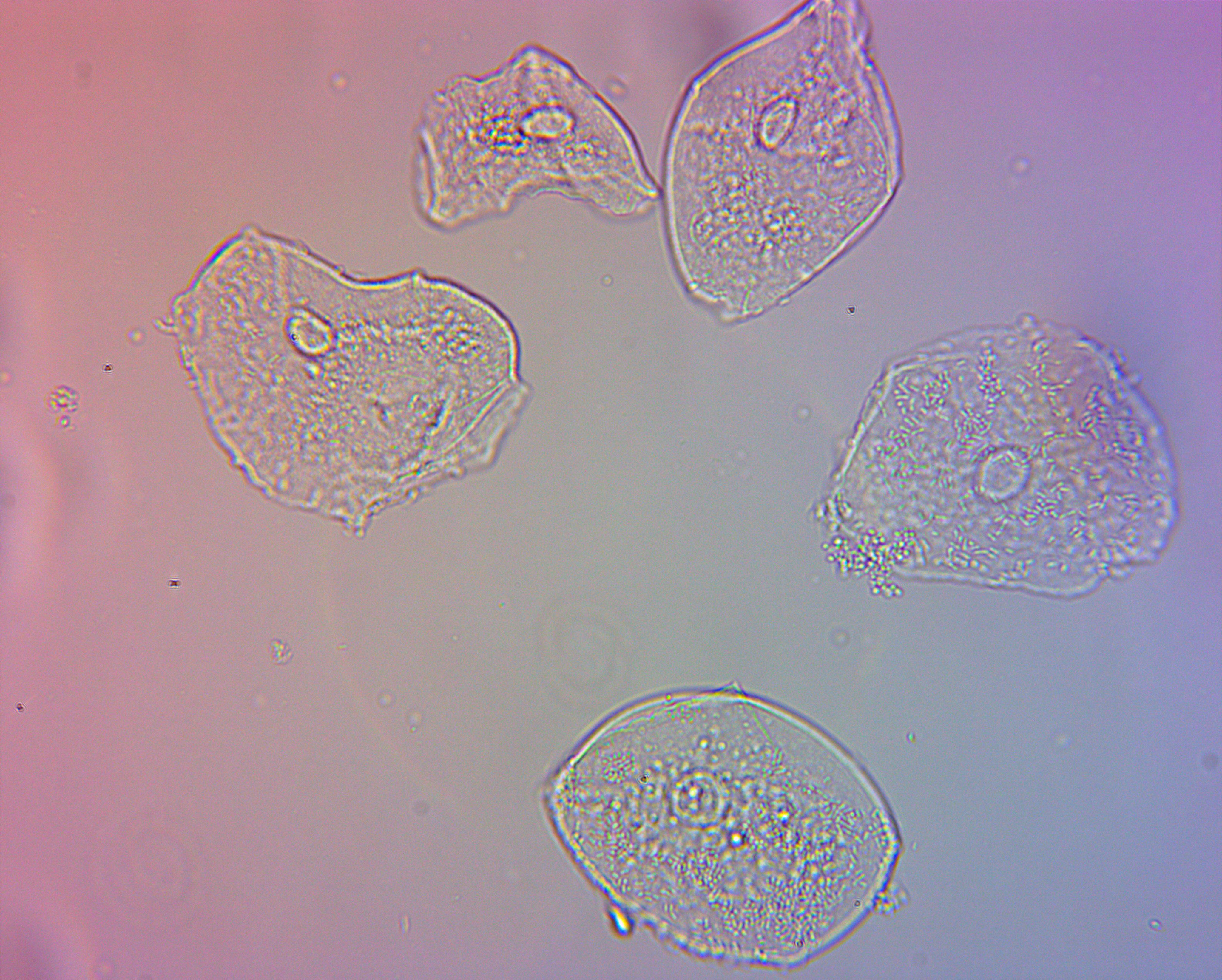 Human cheek cells viewed through an OMAX achromatic 40X NA0.65 160/0.17 objective lit through an OMAX dry brightfield Abbe NA1.25 condenser captured by an OMAX 14.0MP USB3.0 camera with 0.5X adapter