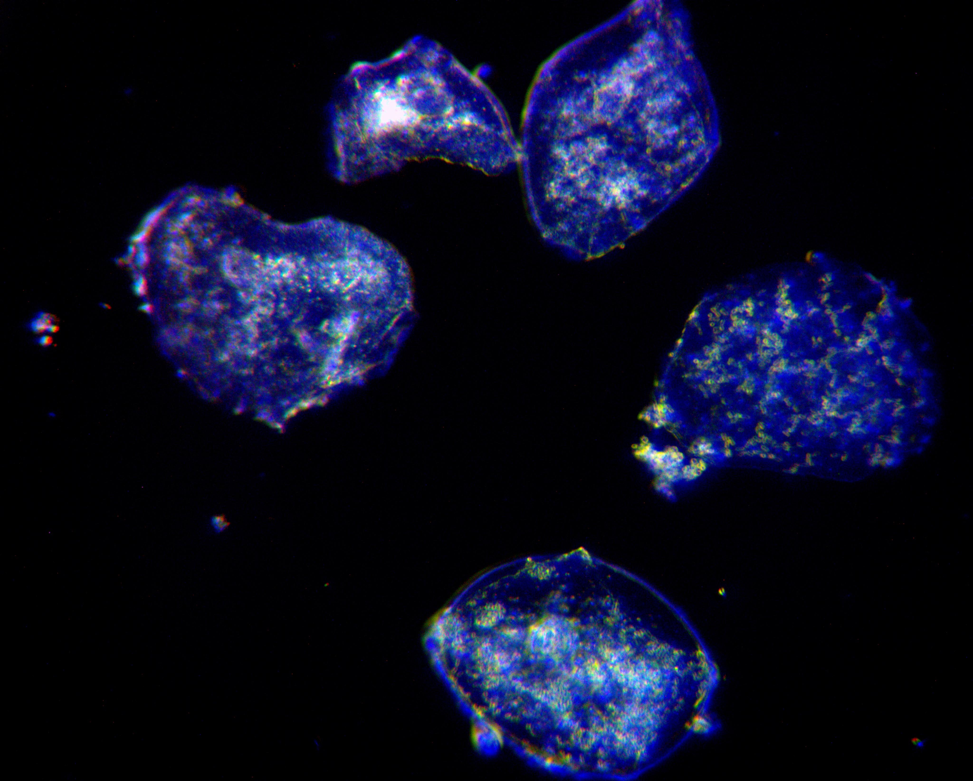 Human cheek cells viewed through an OMAX achromatic 40X NA0.65 160/0.17 objective lit through an OMAX dry darkfield NA0.7-0.9 condenser captured by an OMAX 14.0MP USB3.0 camera with 0.5X adapter