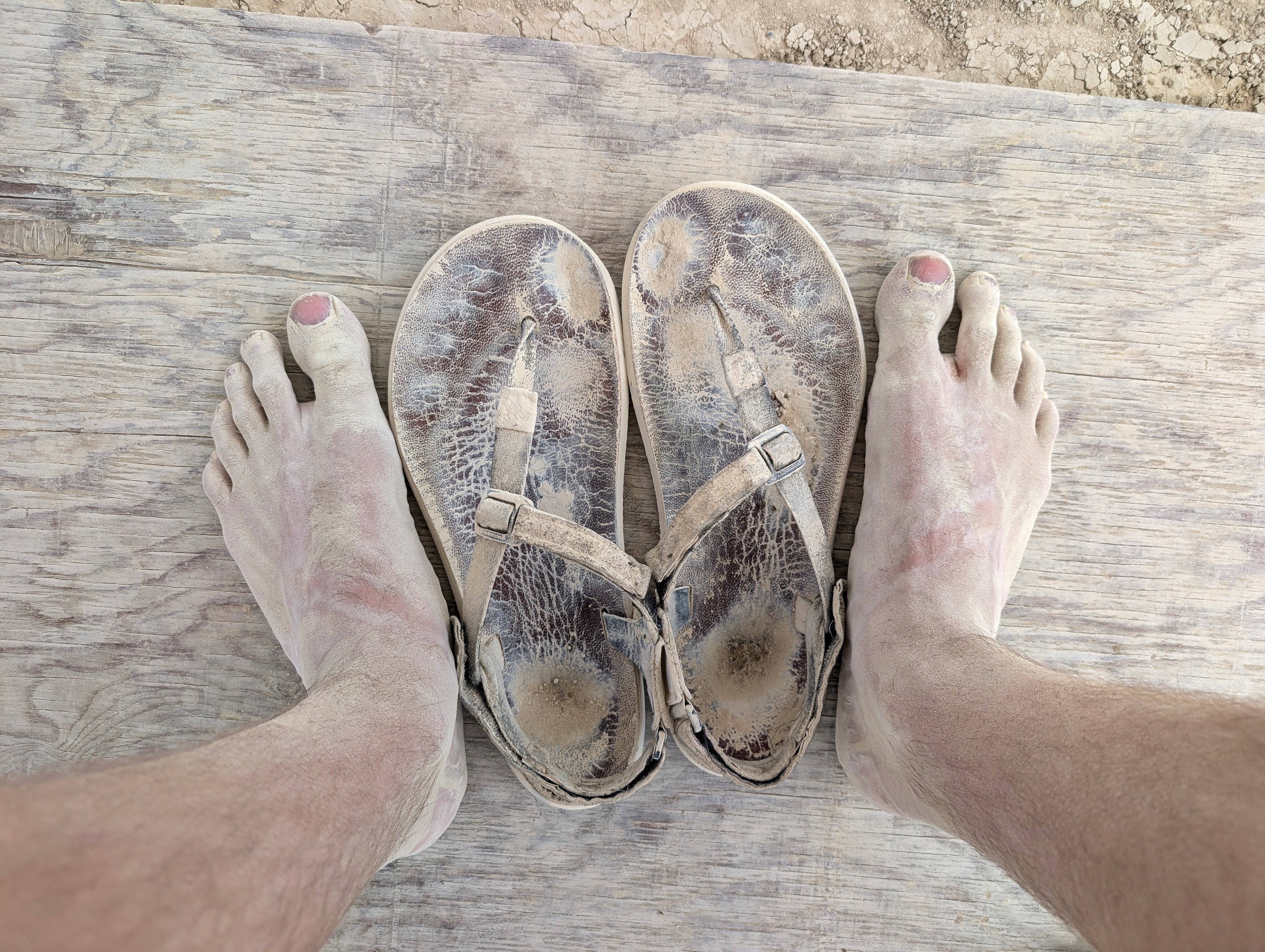 My humble feet after the Burning Man 50K